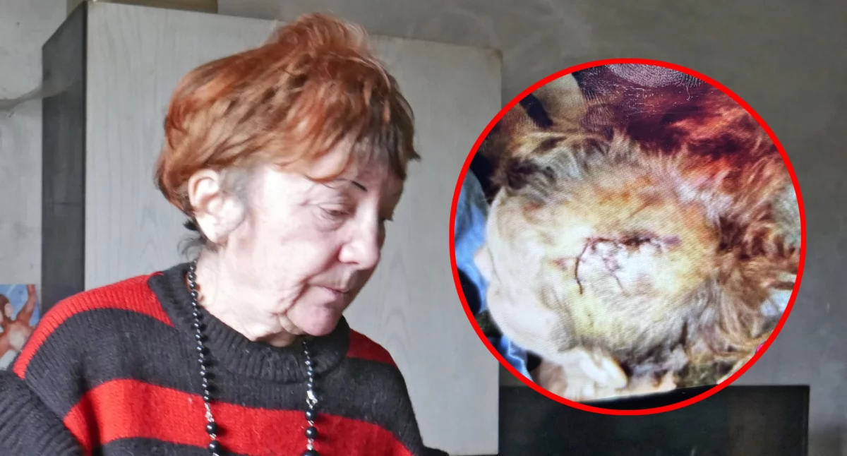 Sąd i prokuratura, pogryzł kobietę policja umorzyła sprawę  - zdjęcie, fotografia