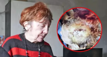 Pies pogryzł kobietę, policja umorzyła sprawę 